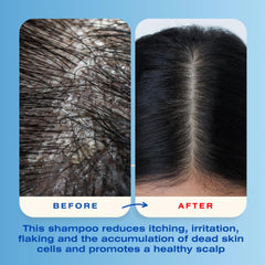 Mediceuticals X-Folate Shampoo unisex packaging appeals to all hair types.