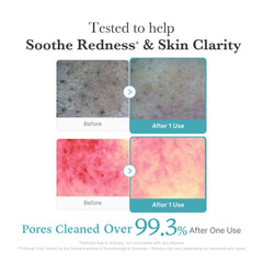 Medicube deep pore care formula with glycerin balances excess oil.