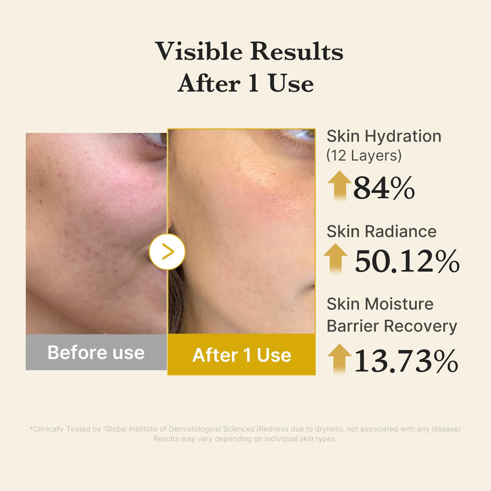 medicube Jelly Mist Serum turmeric extract adds soothing antioxidant benefits.
