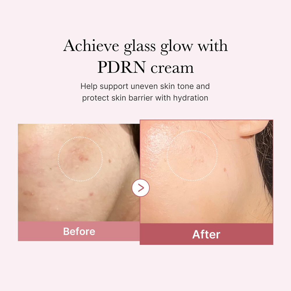 Medicube PDRN Hyaluronic Cream on skin highlighting improved texture