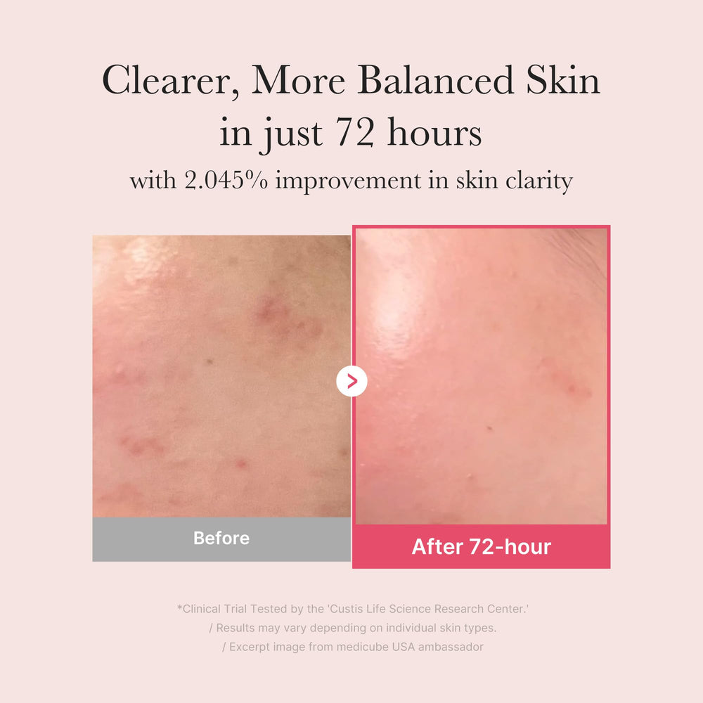 Medicube TXA+Niacinamide Glow Serum swatch on skin shows even tone and light texture