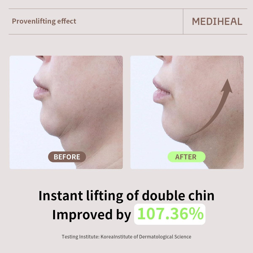 Mediheal Mild Formula is suitable for sensitive skin.