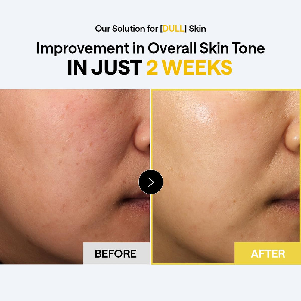 Mediheal sheet mask-style pads ready for targeted treatment.