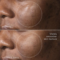 Medik8 C-Tetra Advanced hyaluronic acid glow detail highlights hydration potential.