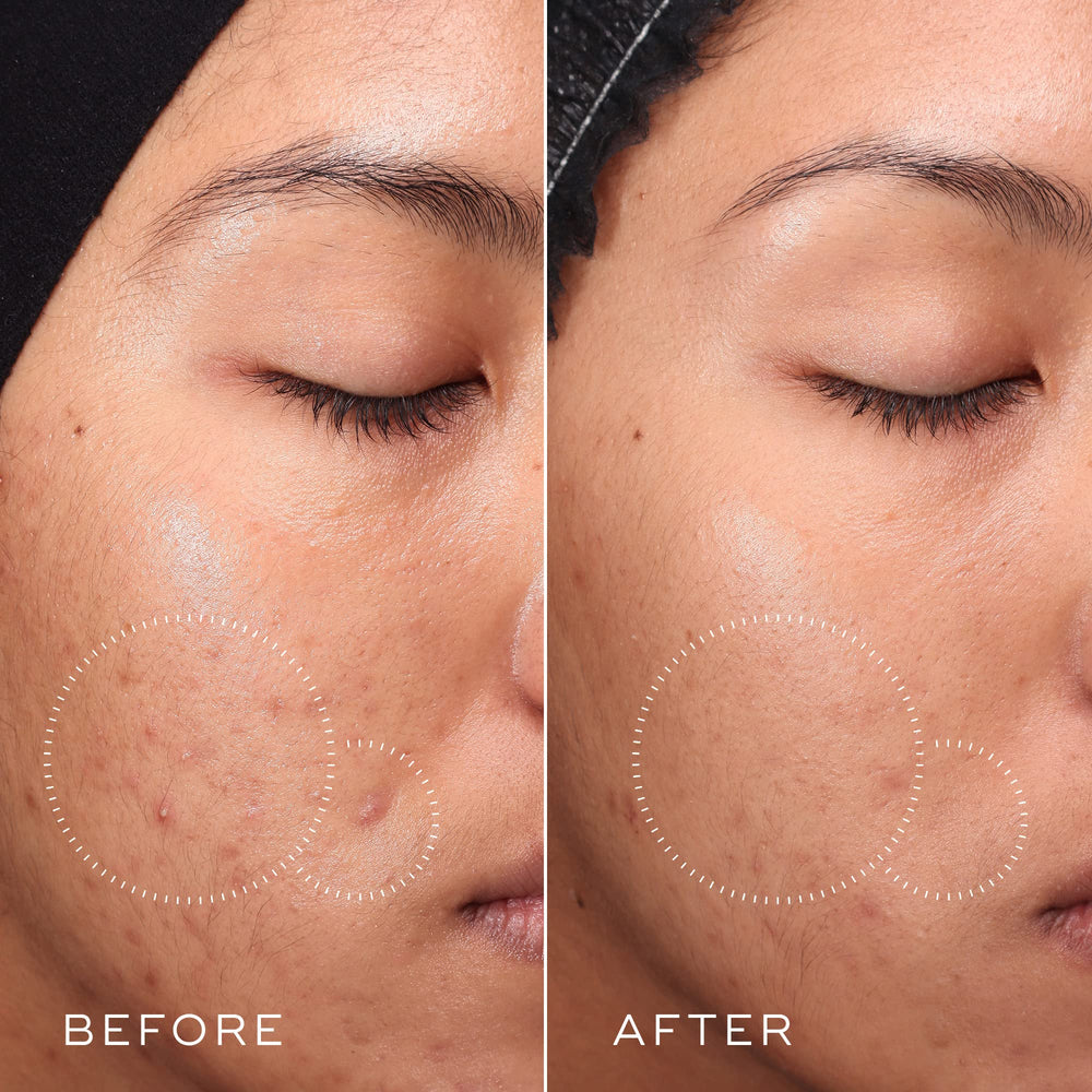 Medik8 Press and Clear toner mist-application hint for quick refreshing use