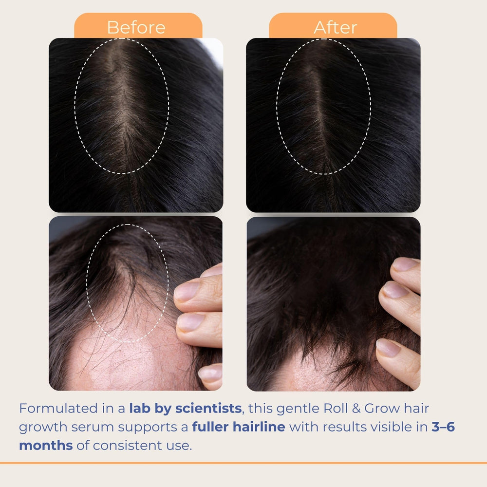 Medulla Clinic Biotin hair boost ingredient supports strand strength