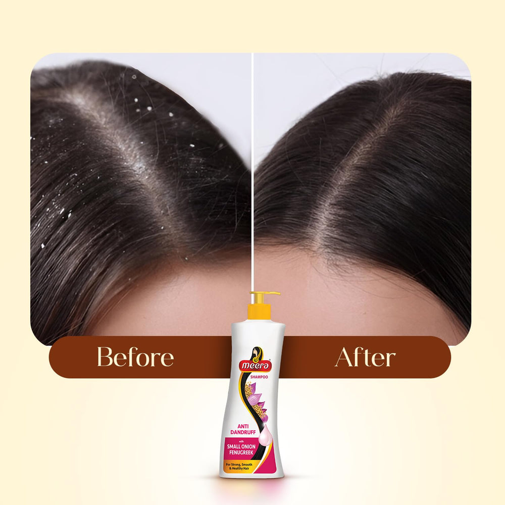 Meera anti-dandruff shampoo packaging flatlay highlighting size and features.
