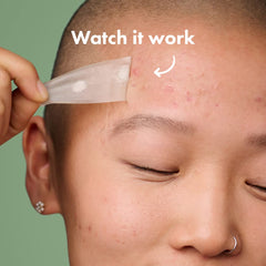 Mighty Patch Surface on chin contours for discreet seal