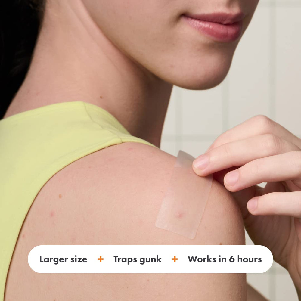 Mighty Patch Surface on forehead absorbs fluids without bulk
