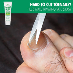 Miracle of Aloe toenail softener cream tube close-up for thick nails