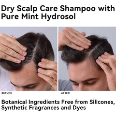 MISSEDSEN refreshed scalp feel after use