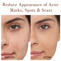 Drops of MMPANG Rosehip Oil on skin demonstrating light, non-greasy coverage.