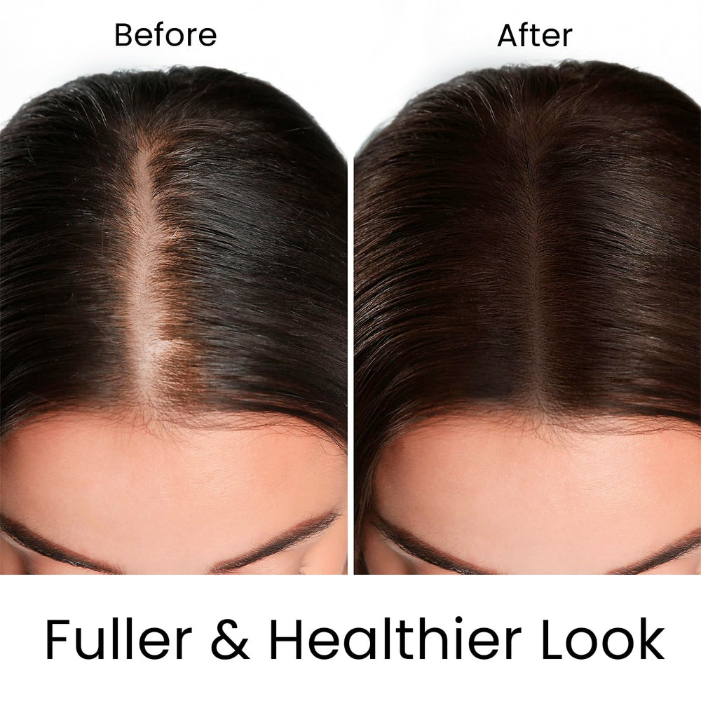 MOEHAIR Hair Guard Shampoo root stimulation supports healthier roots.