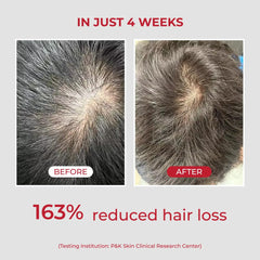 Biotin nutrition focus in MOEV ANNURCATIN formula for roots