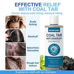 Morovan Coal Tar Shampoo rich foam demonstrates gentle scalp cleansing.