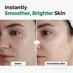 MOTHER MADE LHA exfoliating aqua peel gel used on body for smoother skin.