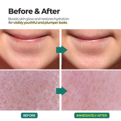 MOTHER MADE LHA Green Tea Aqua Peel Gel aids pore refinement