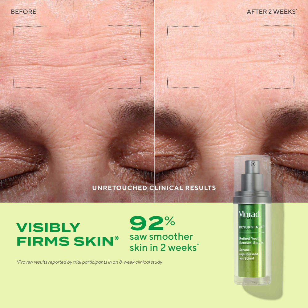 Murad Youth Renewal Eye Serum tube, 360-degree application for refreshed eye area.