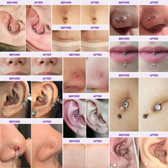 MURASAKI BEAUTY keloid gel tube closeup highlighting scar-smoothing action.