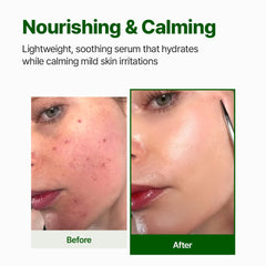 Golden-tinged serum highlights Centella richness and skin-calming potential.