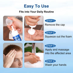 Beard area treated with minoxidil foam.