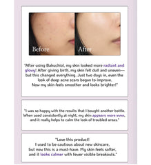 Nano Recipe Bakuchiol Concentrate application on skin demonstrates gentle use.