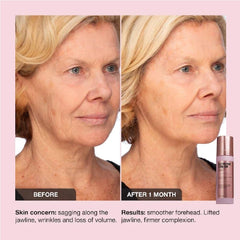 NAPH iNNBEAUTY PROJECT Extreme Cream visibly firms and lifts facial contours