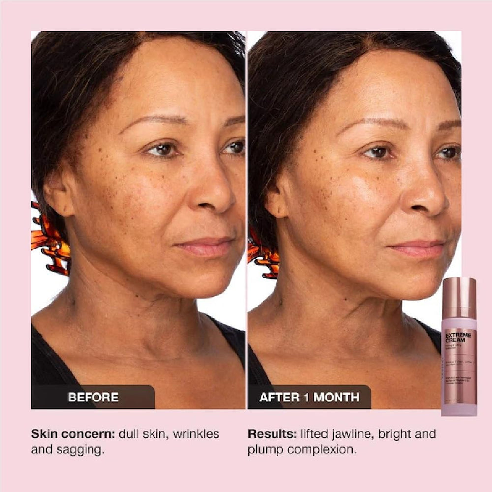 NAPH iNNBEAUTY PROJECT Extreme Cream demonstrates daily application for lifting look