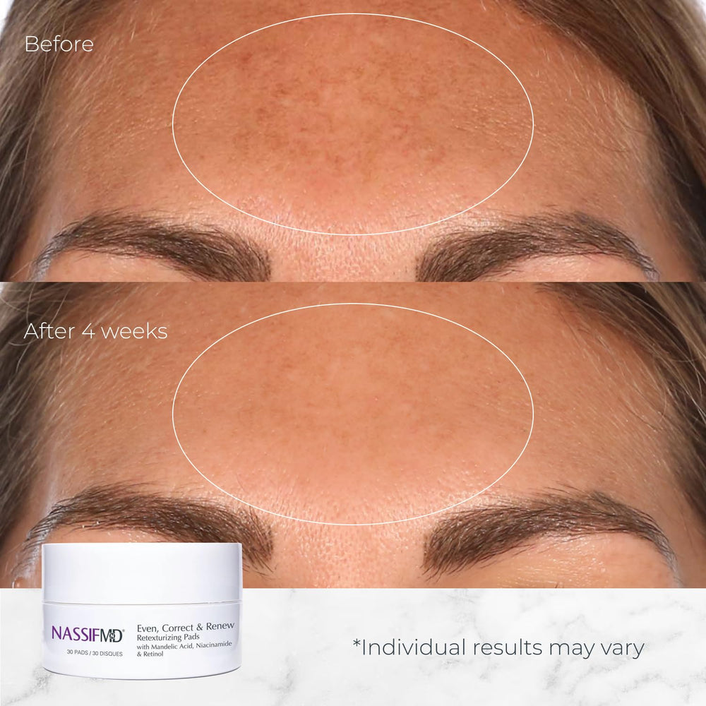 Retinol in NassifMD pads supports renewal with calm, controlled use