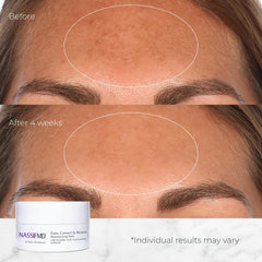 Retinol in NassifMD pads supports renewal with calm, controlled use