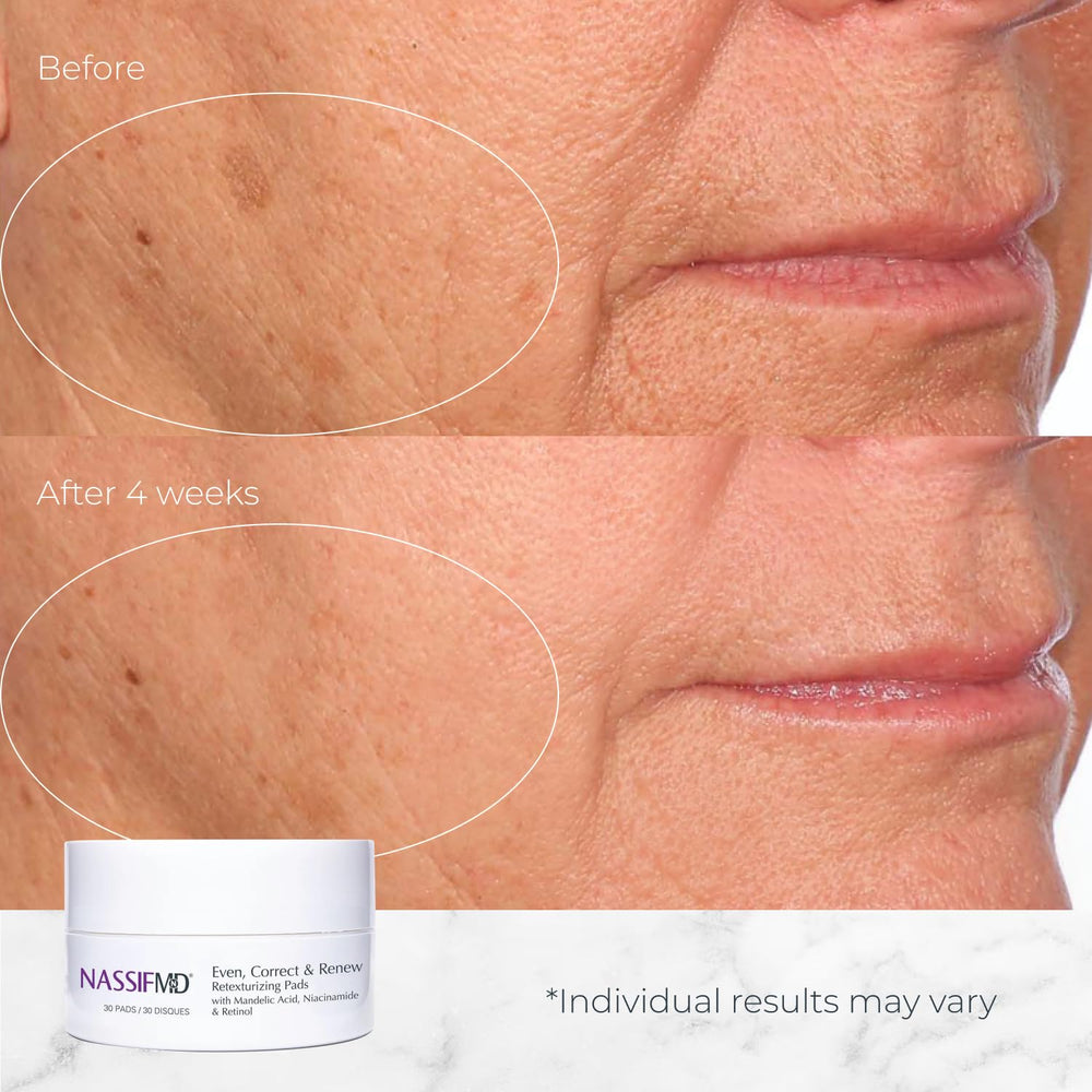 Travel-friendly NassifMD pads ideal for on-the-go skincare routines