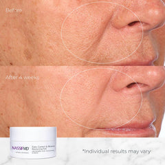 Hydration boost from hyaluronic acid in NassifMD pads during use