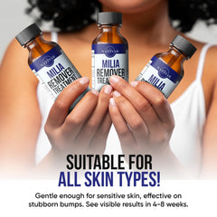 Nativae Milia Remover packaging close-up highlights safe formulation.