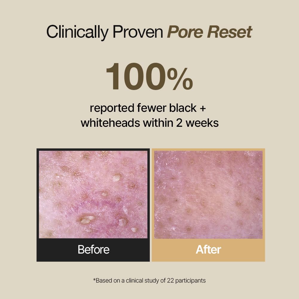 NATURAL DERMA PROJECT pH 5.5 barrier-safe cleanser supports balanced skin cleansing.