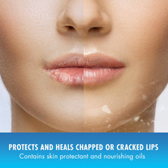Natural Ice SPF 15 lip balm supports moisturized lips during outdoor activities