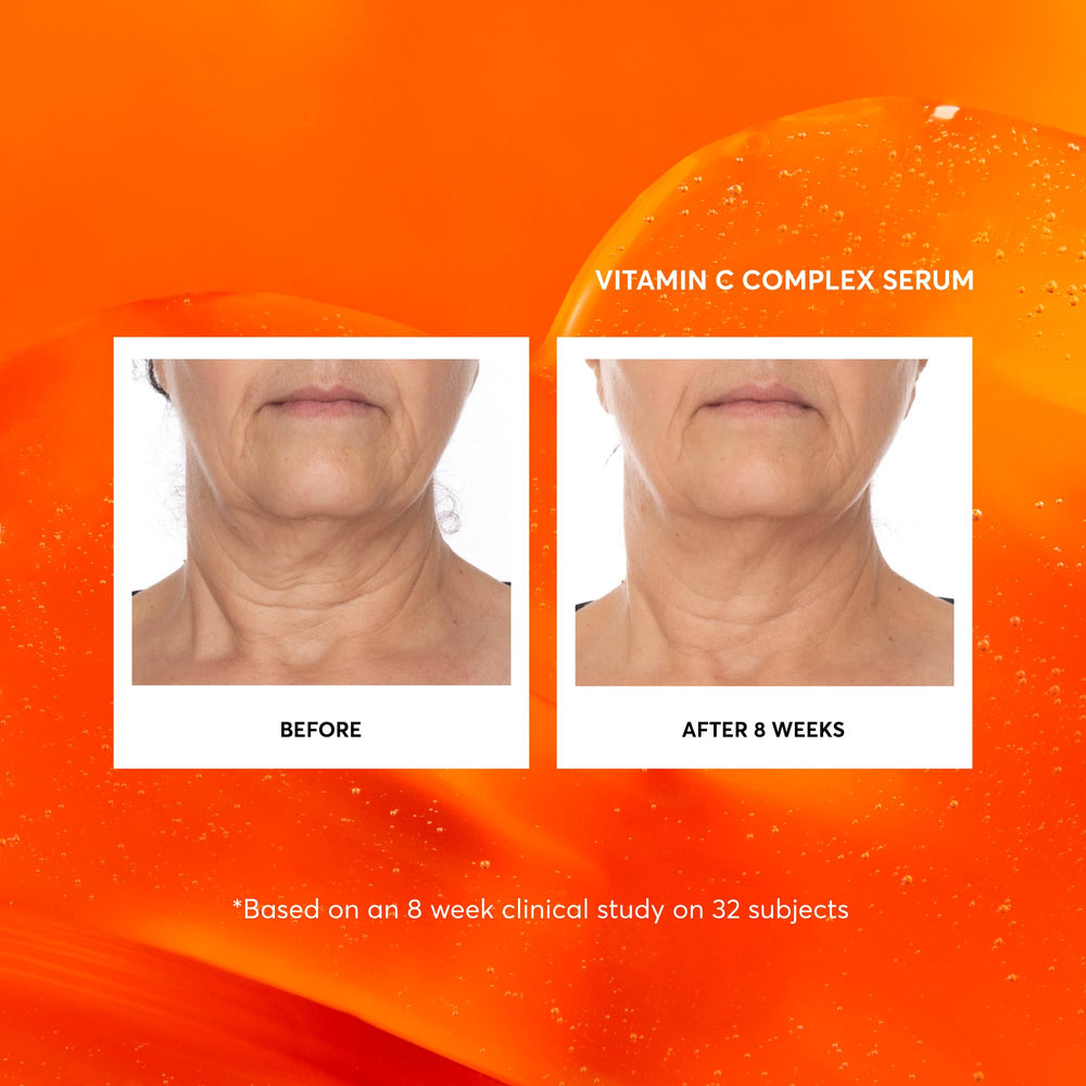 Naturium Vitamin C Complex Serum packaging highlighting jumbo bottle size