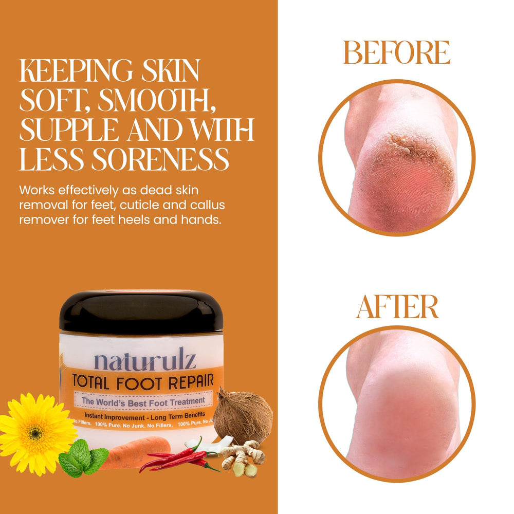 Naturulz Total Foot Repair jar dispense demonstrates easy daily application for dry feet