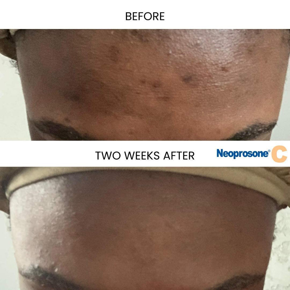 Dropper detail illustrating precise nightly application with smooth serum flow.