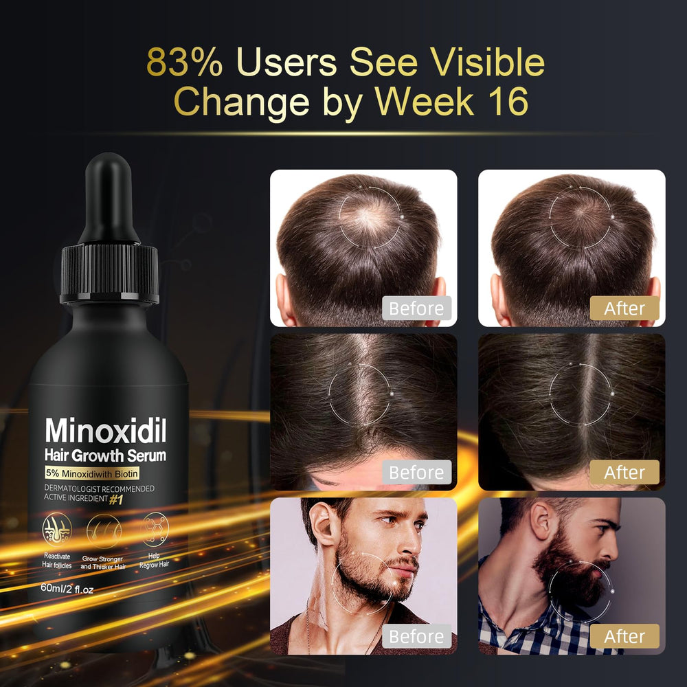 NETYIYUN hair growth serum packaging displays full 2 oz bottle and ingredients.