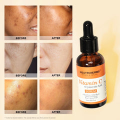 Neutriherbs Vitamin C Serum with Hyaluronic Acid emphasis on hydration boost