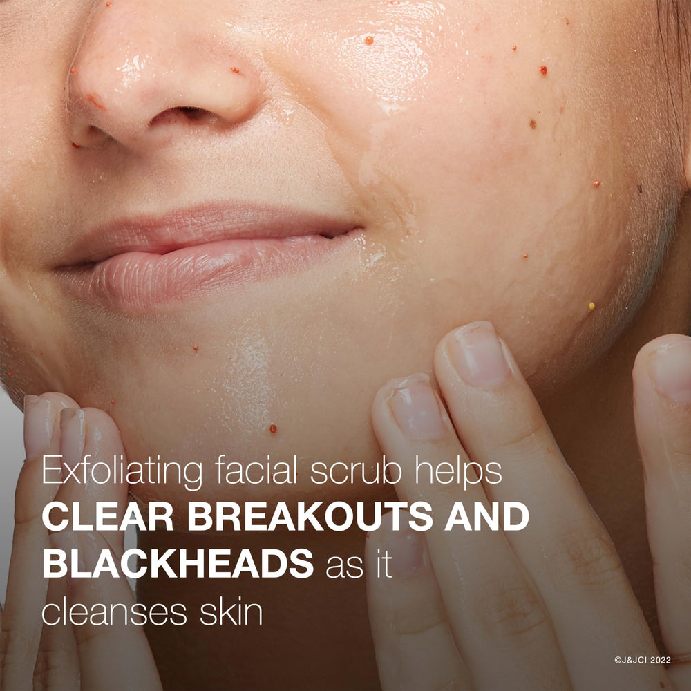 Neutrogena Acne Wash close-up focusing on pore-clearing action.