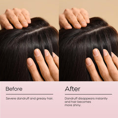 NEWREY shampoo bottle shows gentle, daily-care suited to sensitive scalps.