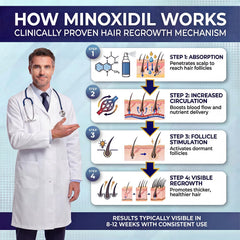 Nigwedete Minoxidil beard application on facial hair for grooming.