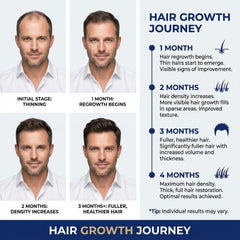 Nigwedete Minoxidil supporting follicle activity for healthier roots.