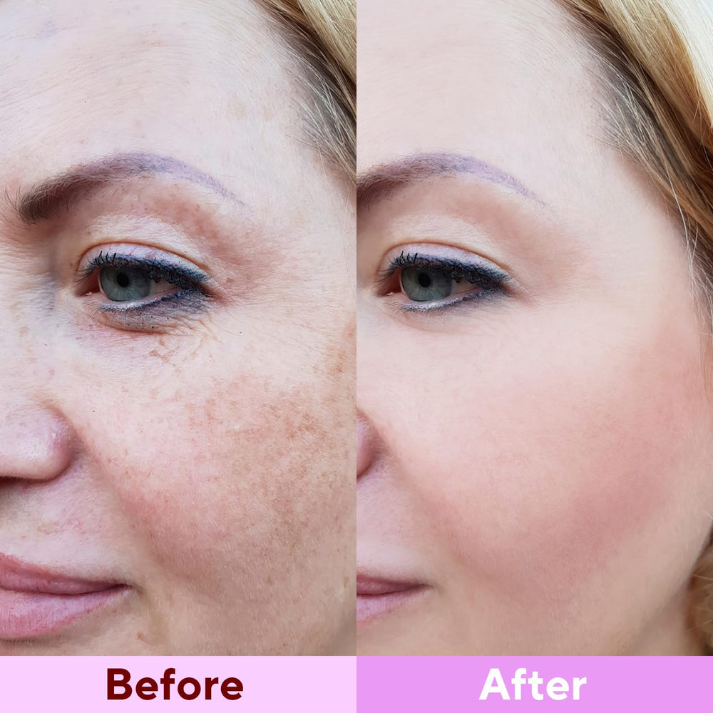 Nityrliv Collagen Face Mask after use skin feels refreshed