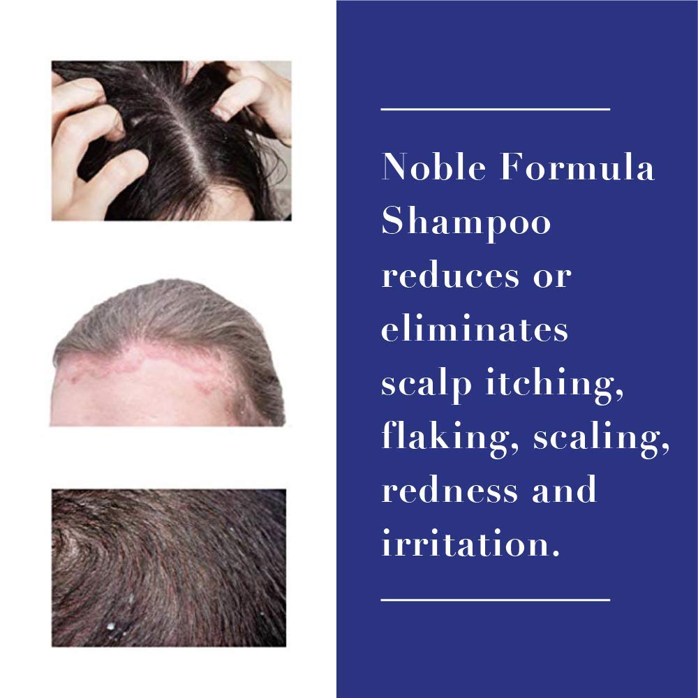 Ingredients scene for Noble Formula 2% Pyrithione Zinc shampoo