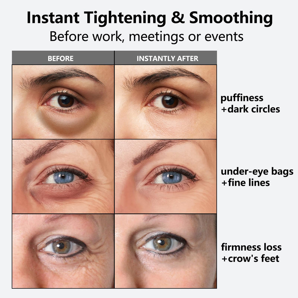 Nofitp Instant Eye Tightener applicator head delivering precise, hygienic application around the eyes.