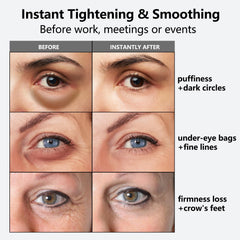 Nofitp Instant Eye Tightener applicator head delivering precise, hygienic application around the eyes.