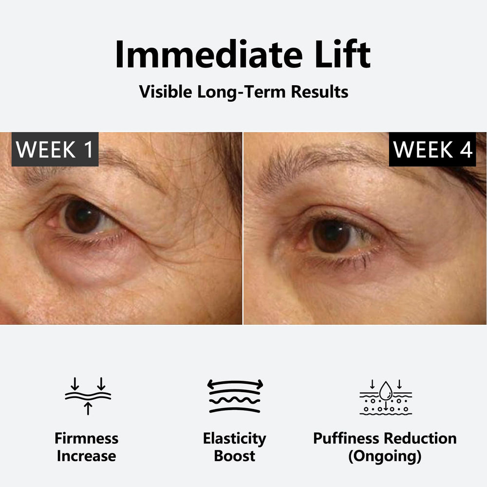 Concept before-after showing potential reduction of puffiness and brightness around eyes.