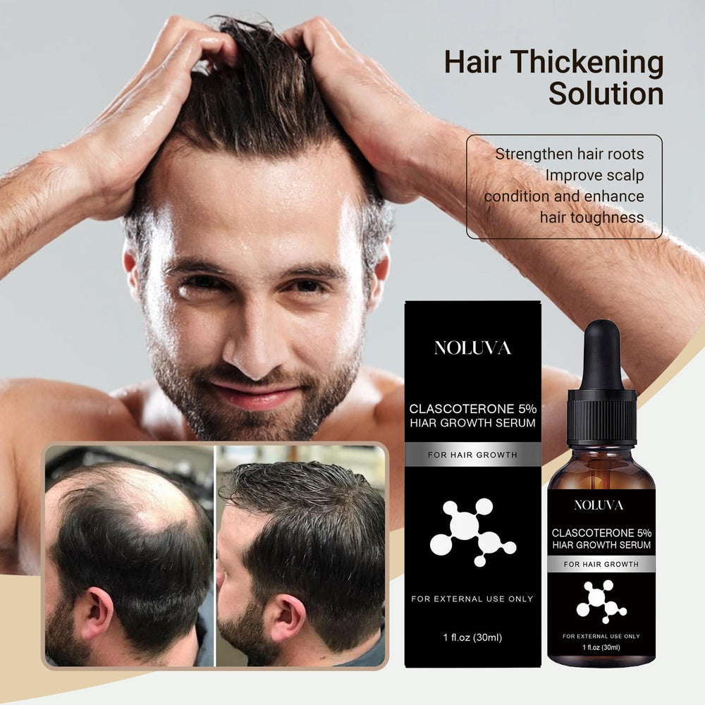 NOLUVA CLASCOTERONE 5% vial showing Vitamin D and Biotin blend for scalp support.